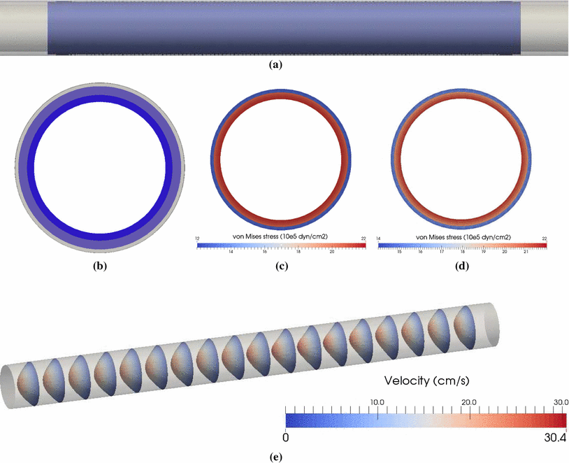 On The Effect Of Preload And Pre Stretch On Hemodynamic - 