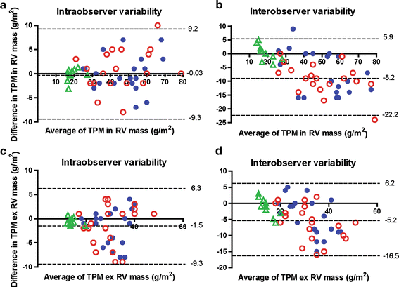 The importance of trabecular hypertrophy in right ventricular
