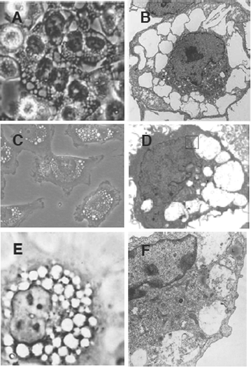 Cytoplasmic vacuolization during exposure to drugs and other substances