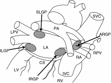 Arrhythmias and vagus nerve stimulation | SpringerLink