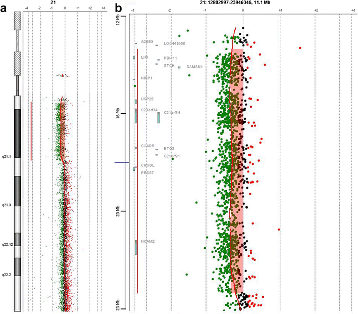 Mosaicism For An Unbalanced Y21 Translocation In An - 