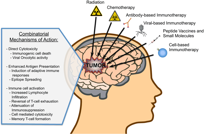 Immunotherapy and radiation in glioblastoma SpringerLink