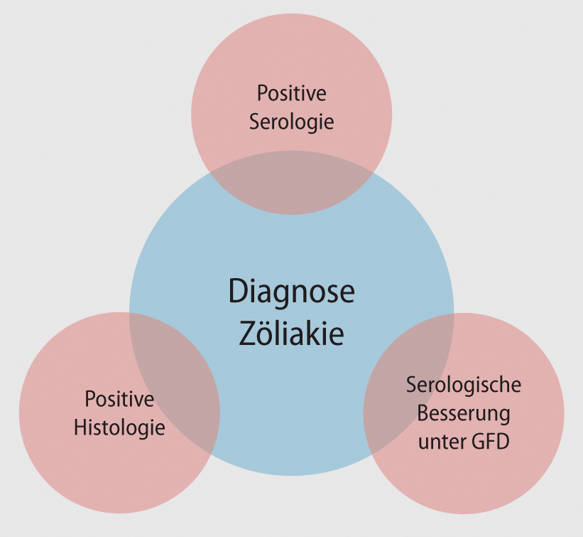 Zoliakie Das Chamaleon Der Gastroenterologie Springerlink