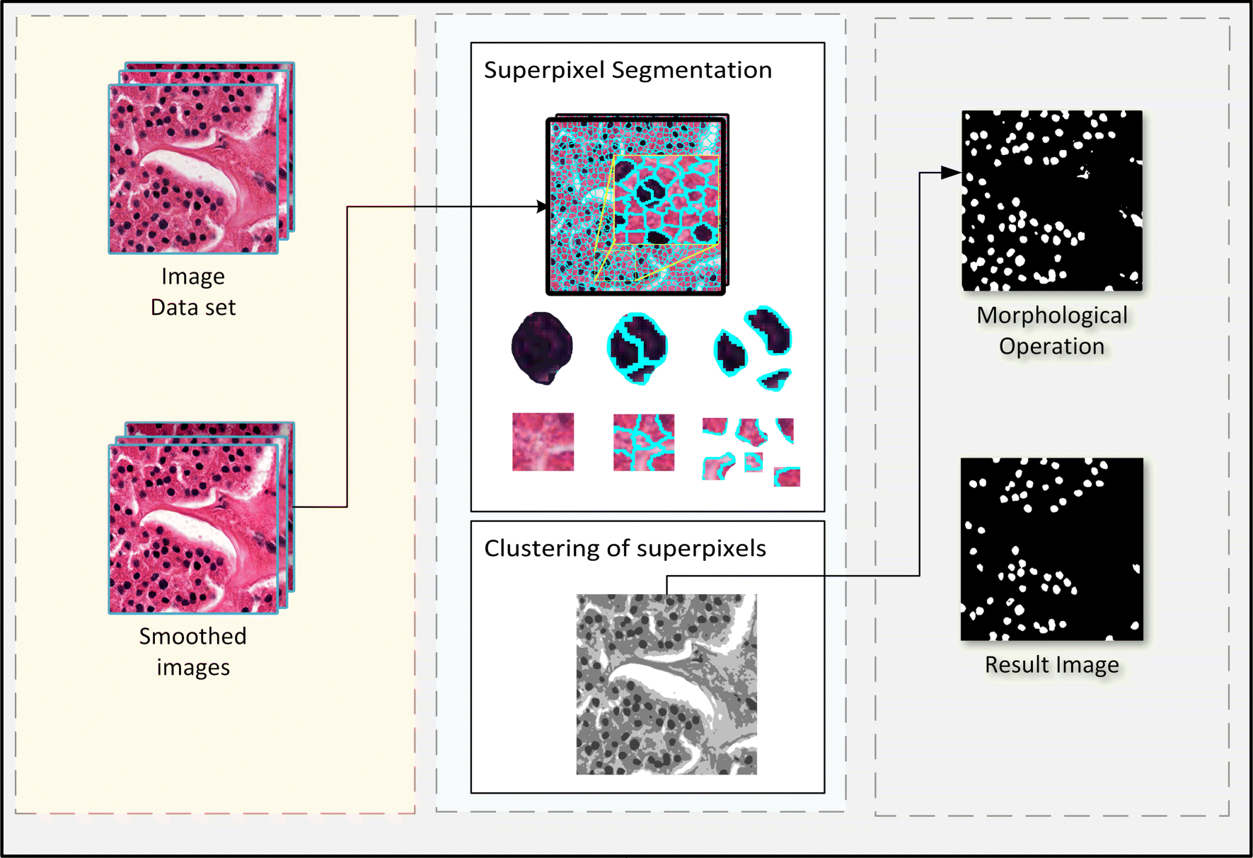 Automatic cell segmentation in histopathological images via two-staged ...