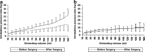 before and after stapled hemorrhoidectomy before and after stapled hemorrhoidectomy