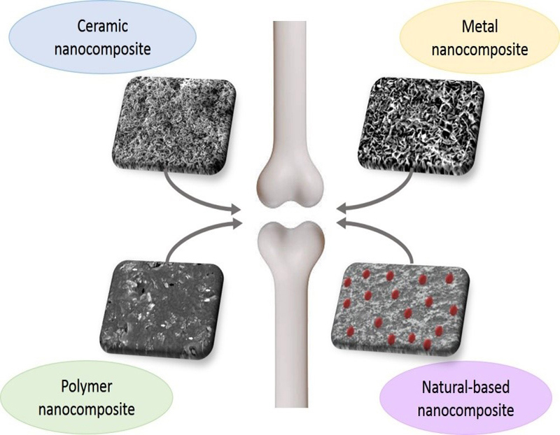 Nanocomposite Materials In Orthopedic Applications - 