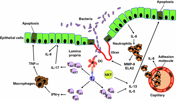 Recent Advances In Understanding Ulcerative Colitis | SpringerLink