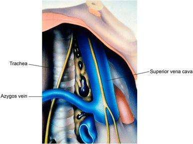 Mediastinal lymph nodes: Ignore? Sample? Dissect? The role of