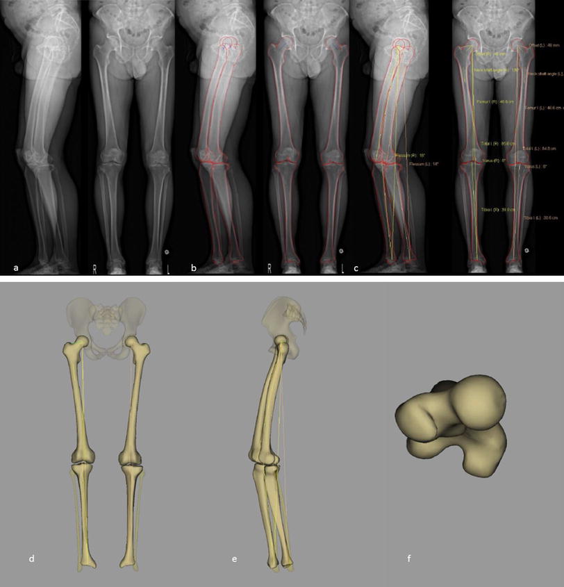 EOS® biplanar X-ray imaging: concept, developments, benefits, and ...