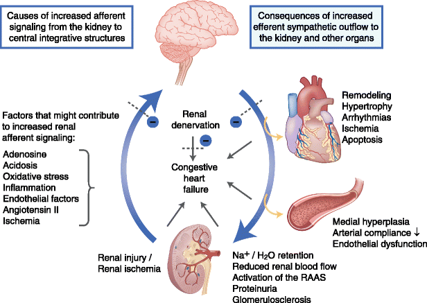 The Role of Renal Denervation in the Treatment of Heart Failure ...