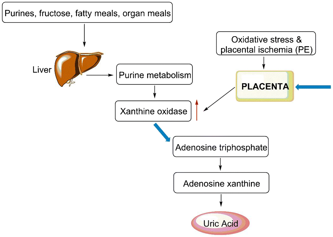 Pathophysiology Of Preeclampsia In Flow Chart