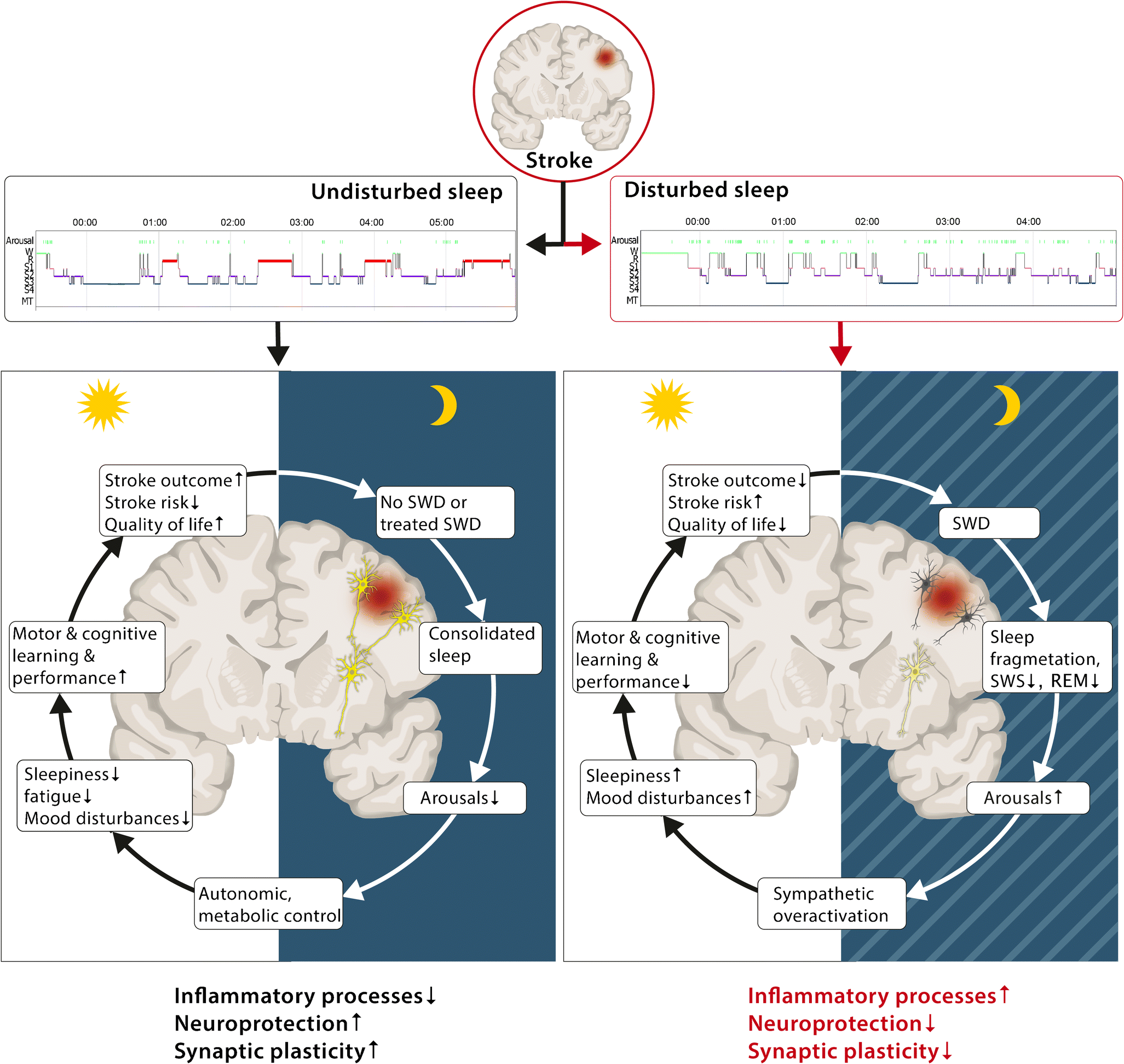 SleepWake Disorders in Stroke—Increased Stroke Risk and Deteriorated