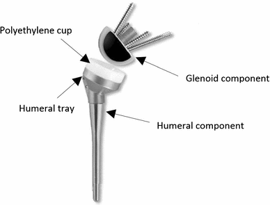 Biomechanical analysis of the humeral tray positioning in reverse ...