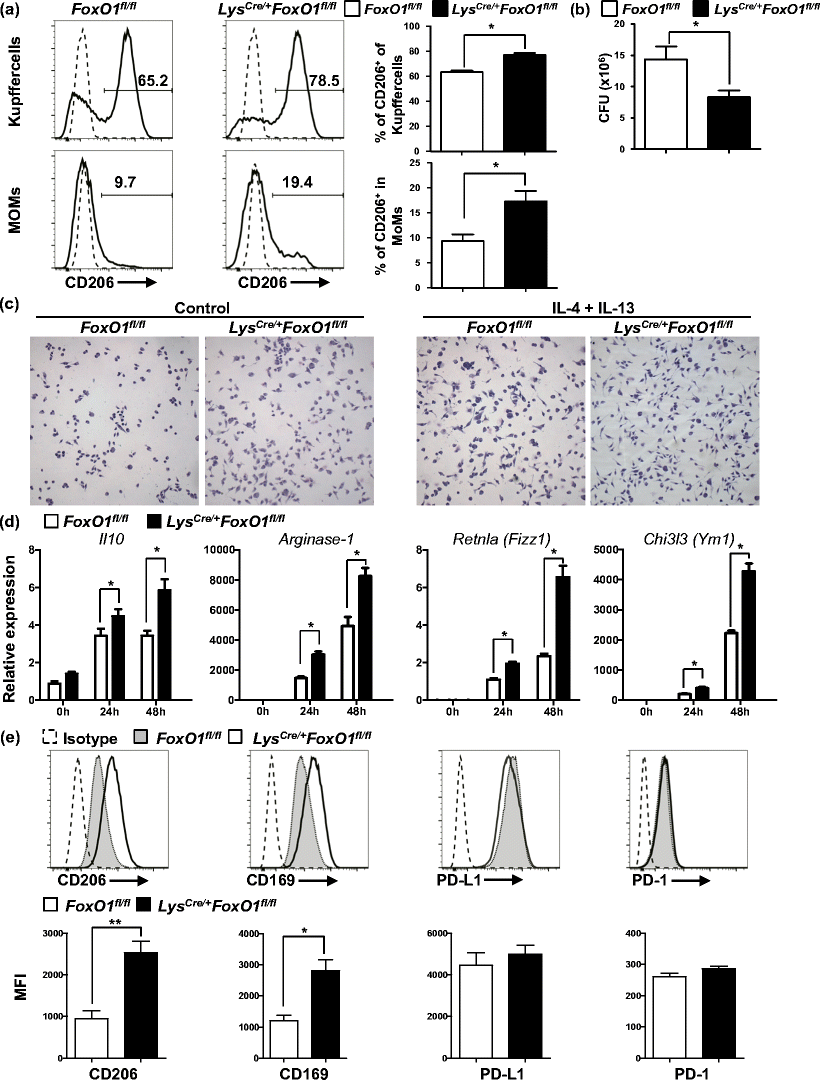 septic helper 2000 premionacionaldeinterventorias open image in new window forkhead box o1 regulates macrophage polarization following septic helper 2000 premionacionaldeinterventorias open image in new window forkhead box o1 regulates macrophage polarization following