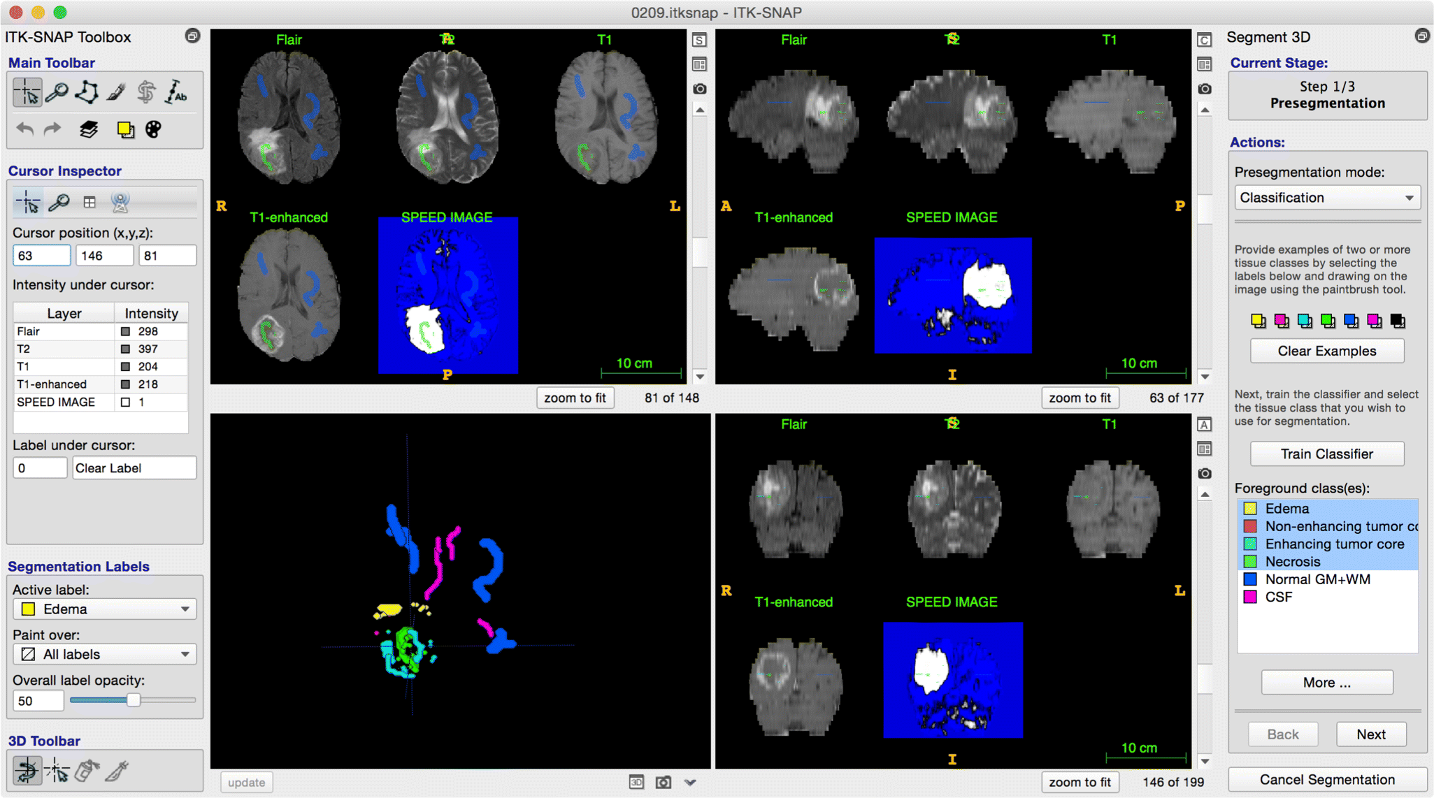 UserGuided Segmentation of Multimodality Medical Imaging Datasets with ITKSNAP SpringerLink