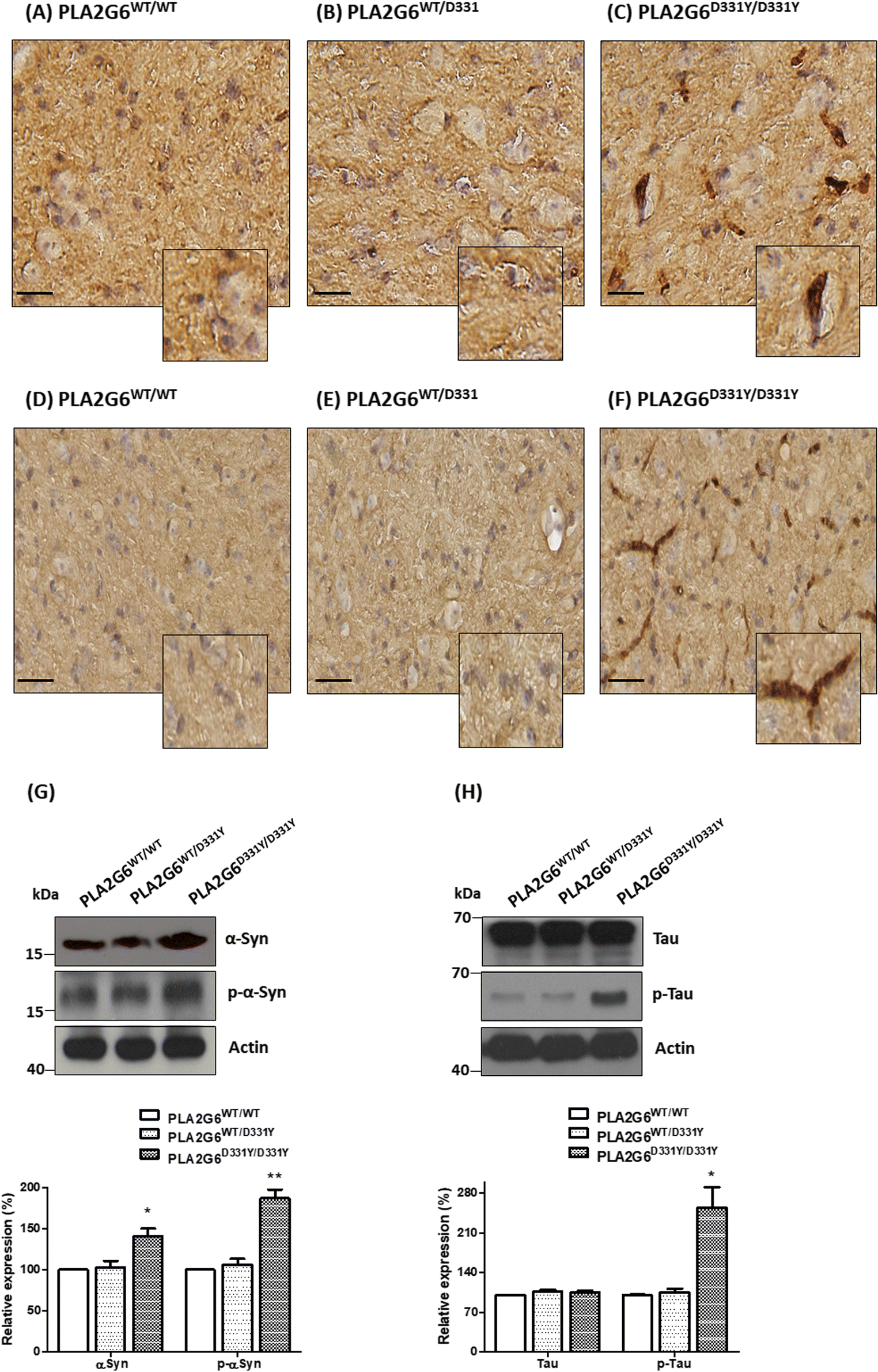 Park14 D331y Pla2g6 Causes Early Onset Degeneration Of Substantia Open Image In New Window
