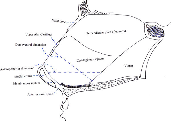 Septoplasty can Change the Shape of the Nose | SpringerLink