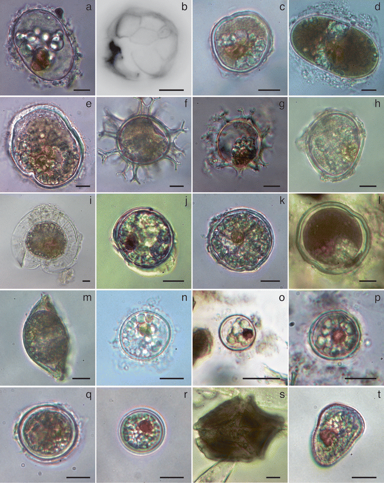 Dinoflagellate Cyst Assemblages in Surface Sediments from Three Shallow ...