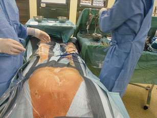 Comparison Of Efficacy And Cost Of Iodine Impregnated Drape Vs
