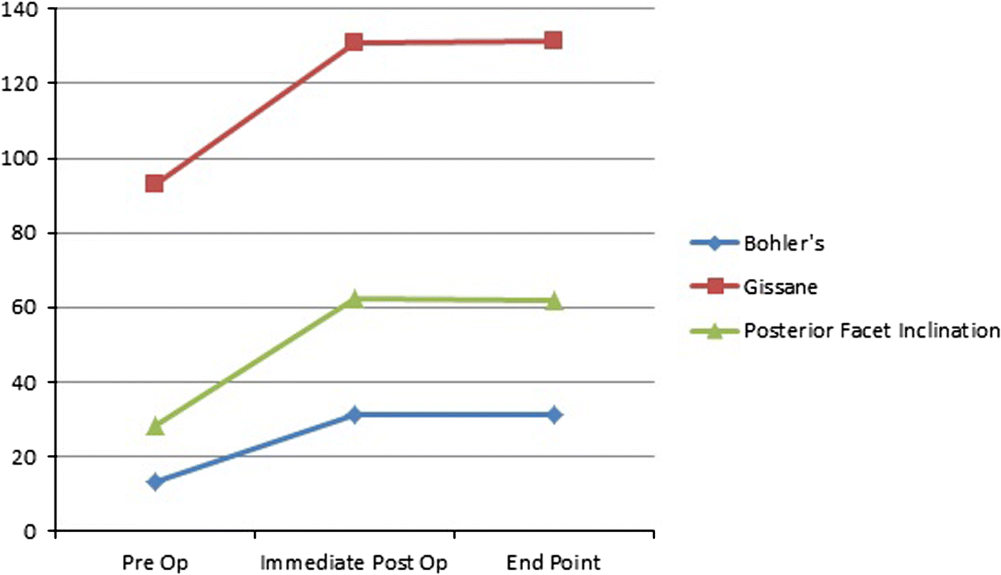 Provisional Fixation Chart