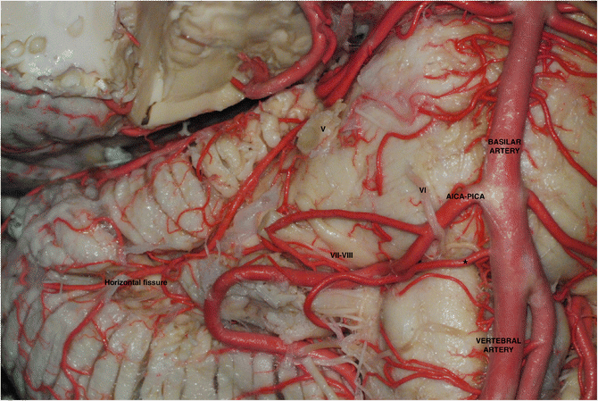 pica artery full form pica artery full form
