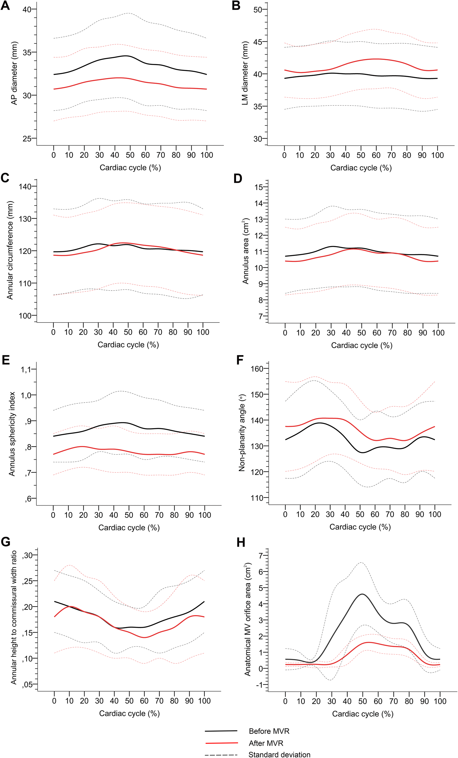 Changes In Dynamic Mitral Valve Geometry During Percutaneous - 