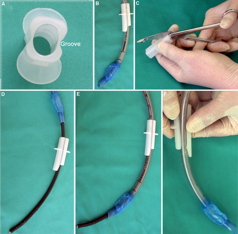 A modified bite block for fibreoptic bronchoscopy in patients with face