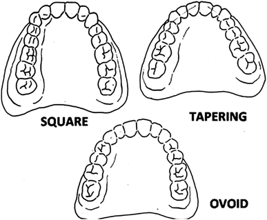 dermatoglyphic assessment in subjects with different dental arch dental arch