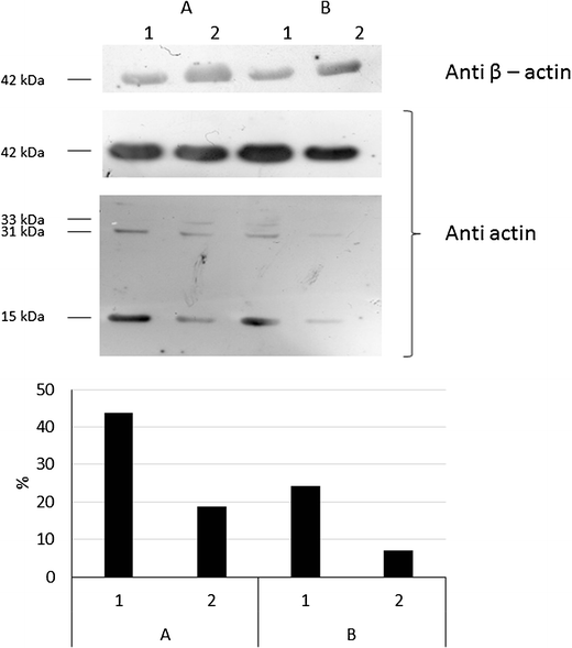 The Effect Of Slaughtering Methods On Actin Degradation And On Muscle Quality Attributes Of Farmed European Sea Bass Dicentrarchus Labrax Springerlink