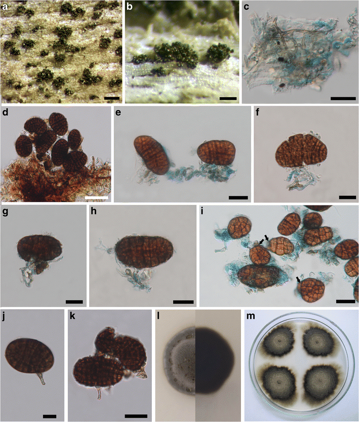 Microfungi On Tectona Grandis Teak In Northern Thailand - 