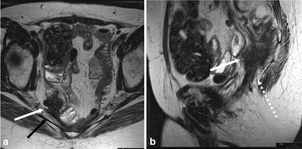 michael colimbini mri tragic accident Issuu is a digital publishing platform that makes it simple to publish magazines, catalogs, newspapers, books, and more online easily share your publications and get them in front of issuu’s millions of monthly readers. michael colimbini mri tragic accident Issuu is a digital publishing platform that makes it simple to publish magazines, catalogs, newspapers, books, and more online easily share your publications and get them in front of issuu’s millions of monthly readers.