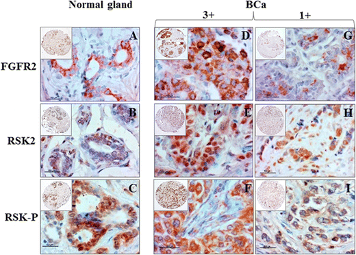 interactions between fgfr2 and
