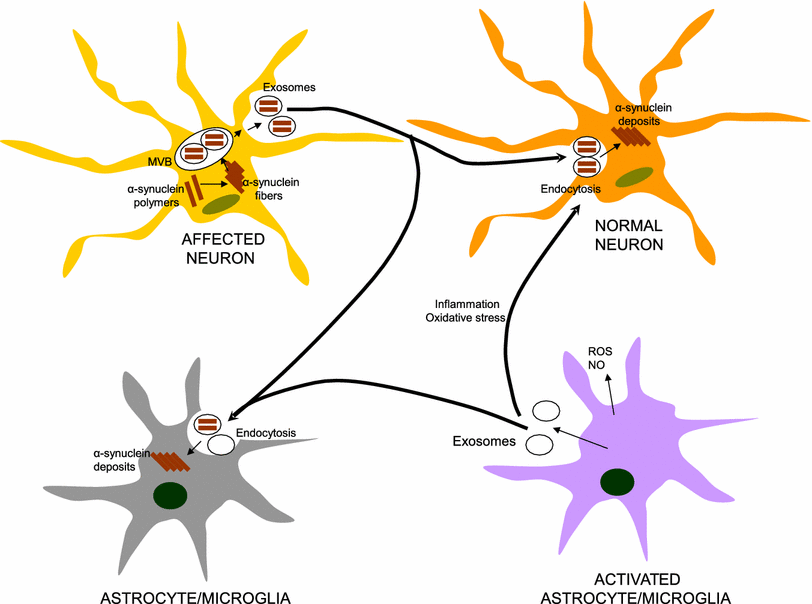 α-Synuclein-carrying extracellular vesicles in Parkinson’s disease ...
