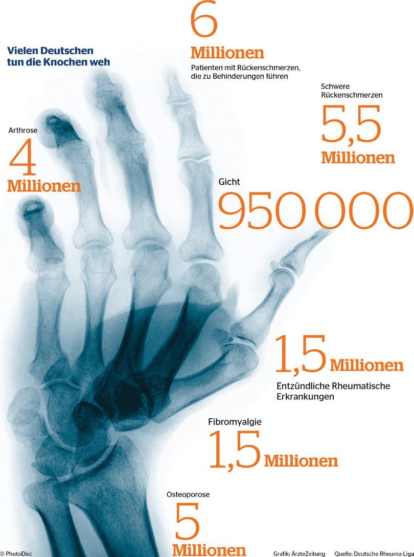 Rheumatologen Mangel Macht Erfinderisch Springerlink