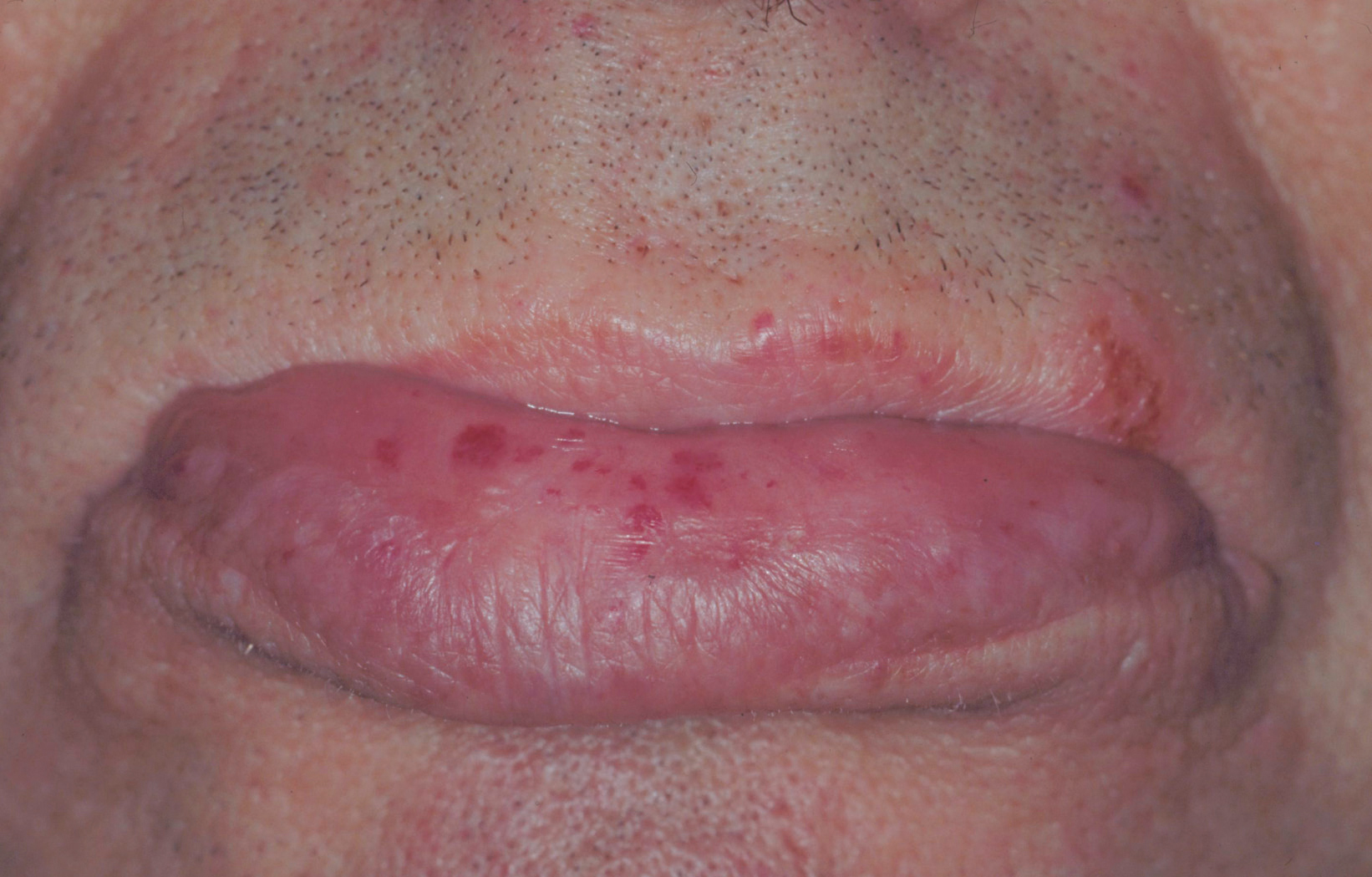 Die Lippen verrieten die Diagnose SpringerLink