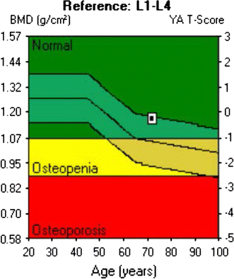 Osteoporosis T Score Chart