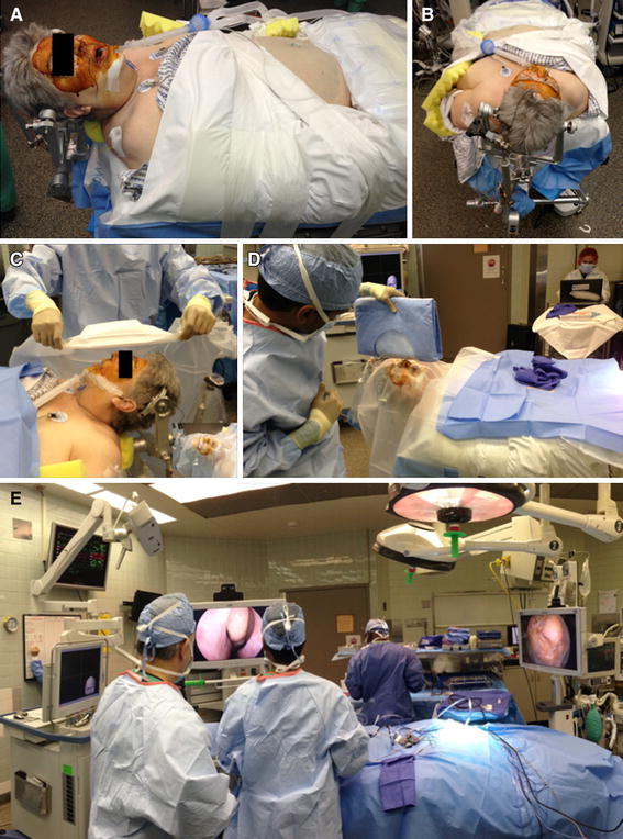 Perioperative Considerations Planning Intraoperative And