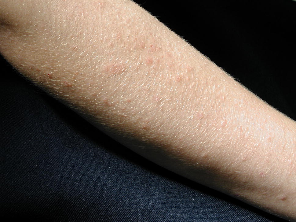 Recent Developments In The Diagnosis And Management Of Recent Developments In The Diagnosis And Management Of