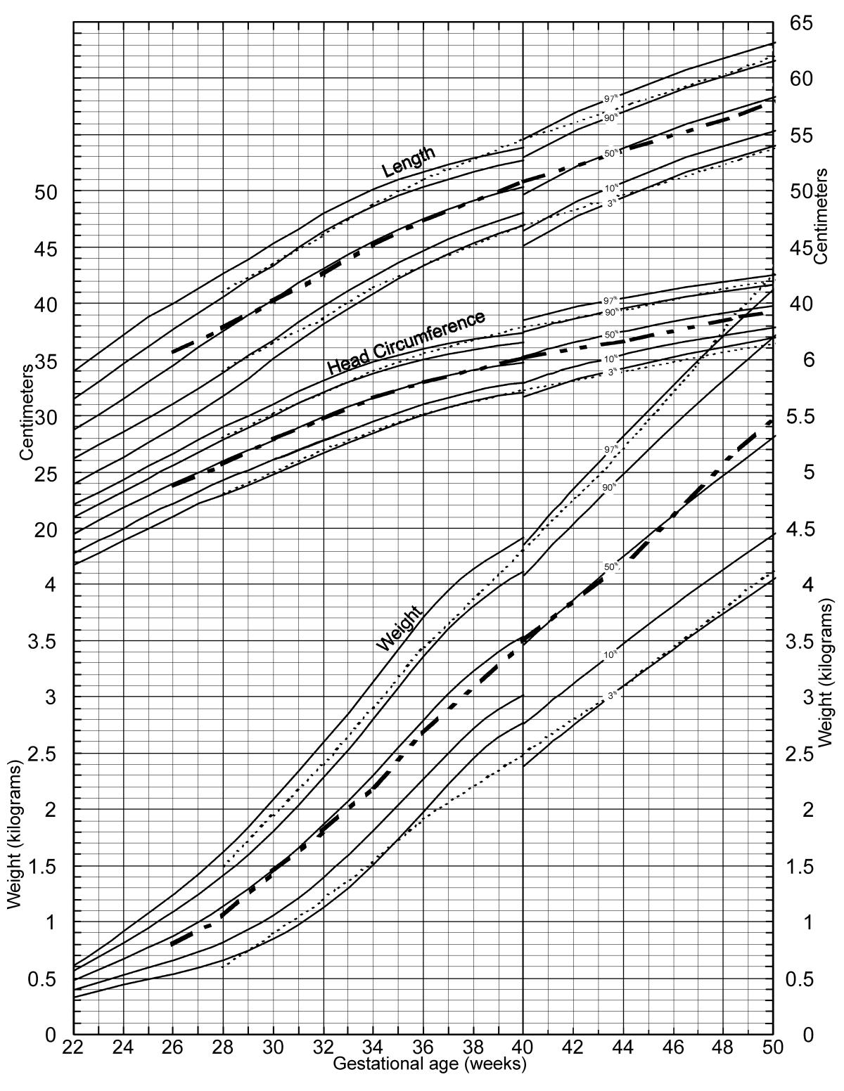 Growth Charts For Premature Infants Cdc