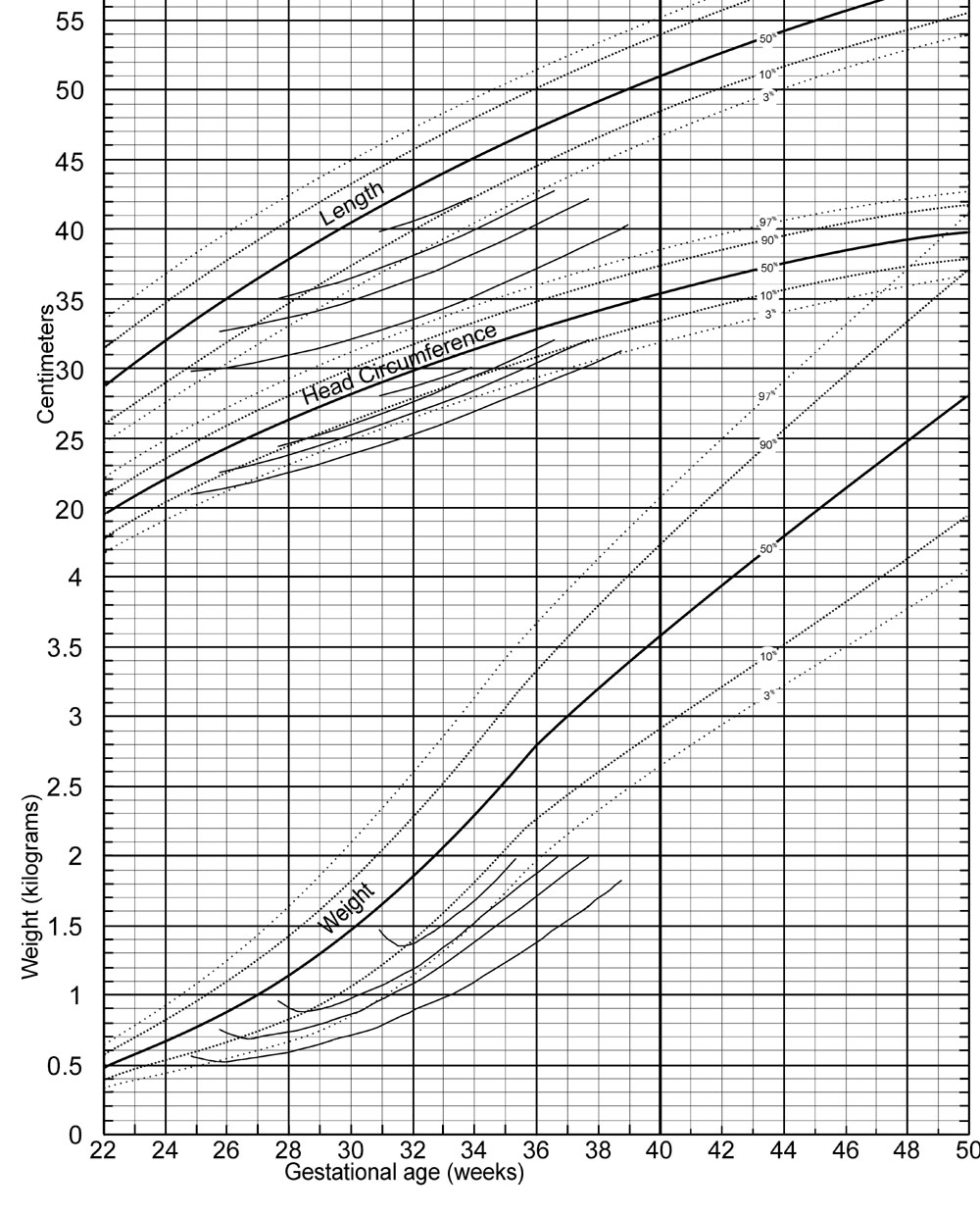 Infant Head Circumference Percentile Chart