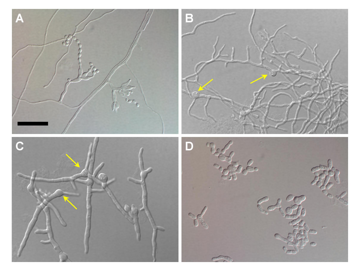 Protein Profiling Of The Dimorphic Pathogenic Fungus - 