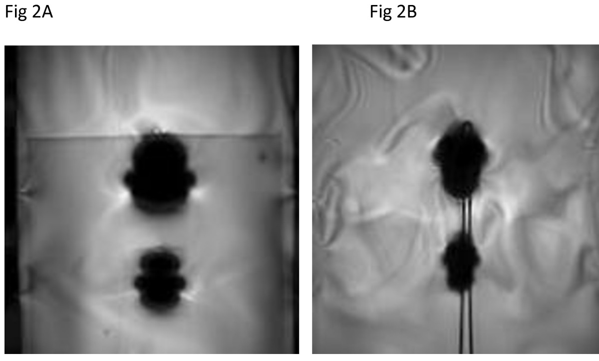 MRI artifacts associated with the skin closure staple (bottom) and hemostat...