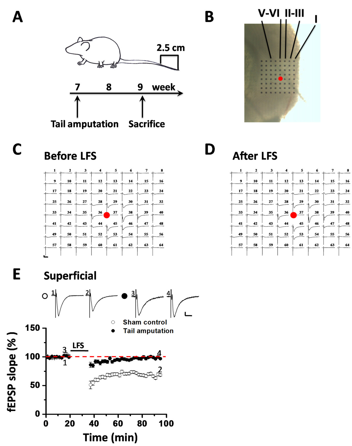 Insular Cortex Alterations In Mouse >> Loss Of Long Term Depression In The Insular Cortex After Tail Insular Cortex Alterations In Mouse >> Loss Of Long Term Depression In The Insular Cortex After Tail