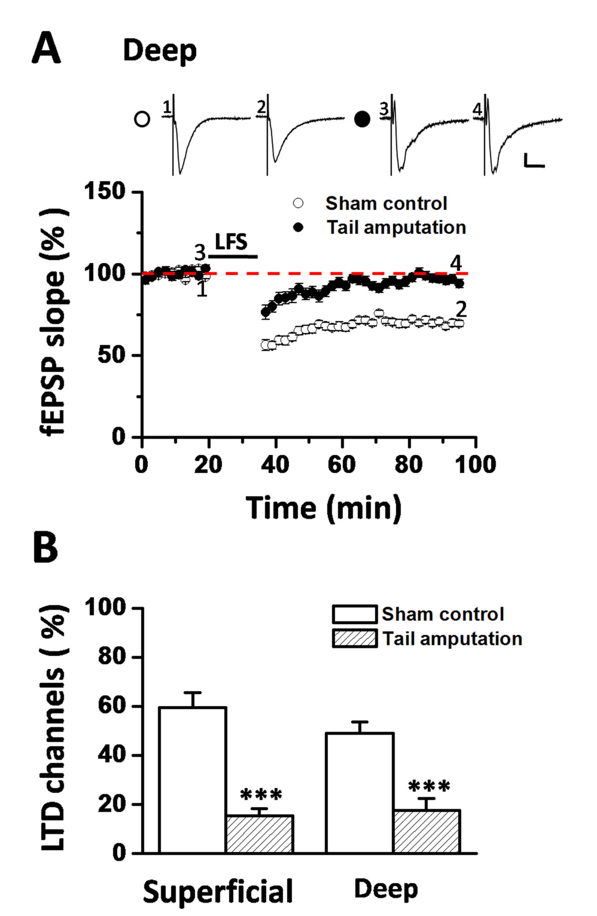 Insular Cortex Alterations In Mouse >> Loss Of Long Term Depression In The Insular Cortex After Tail Insular Cortex Alterations In Mouse >> Loss Of Long Term Depression In The Insular Cortex After Tail