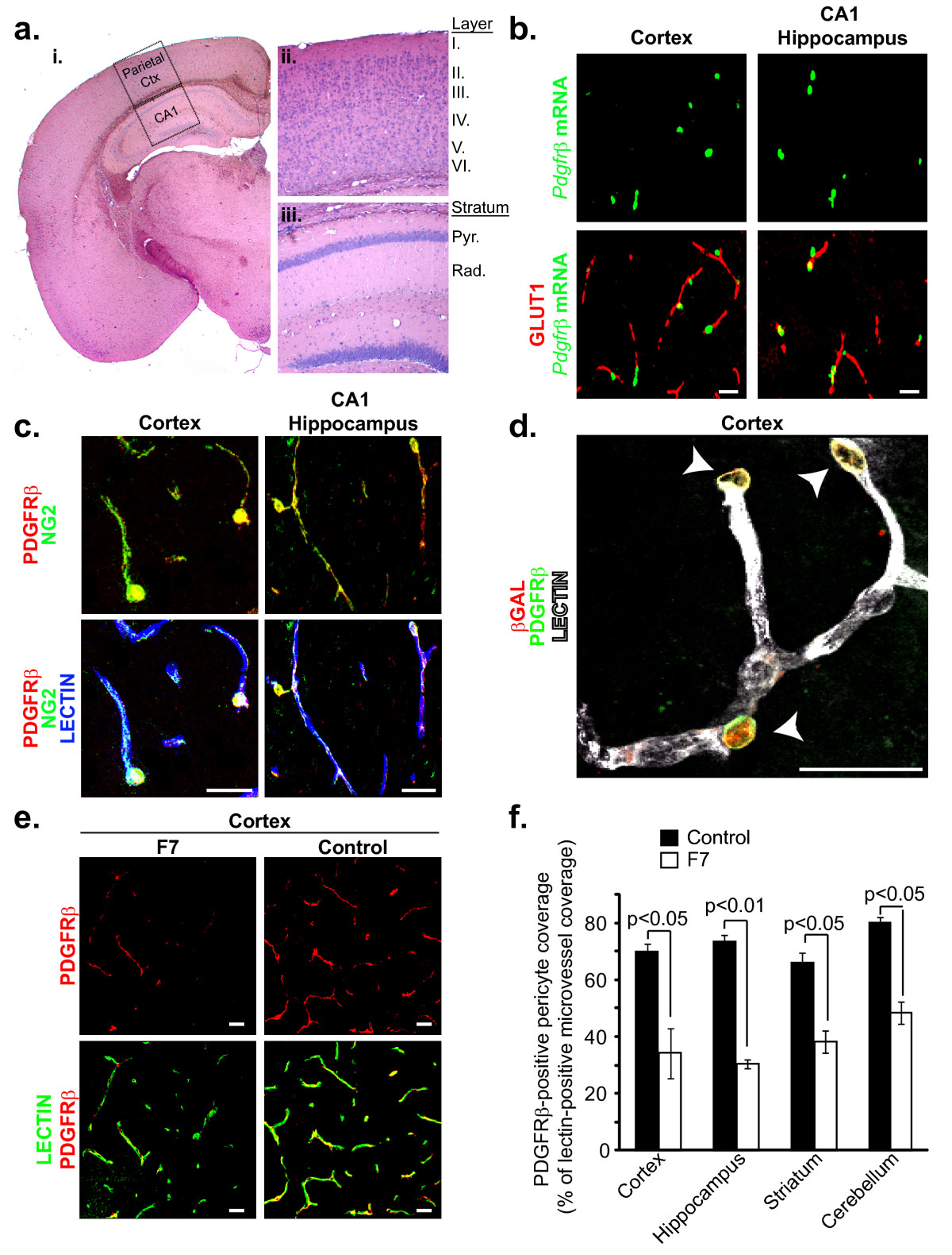 Pericytespecific expression of PDGF beta receptor in mouse models with