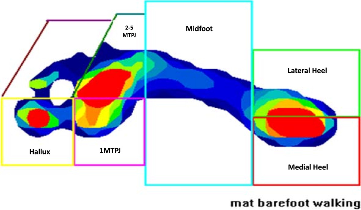 Foot loading patterns in normal weight, overweight and obese children