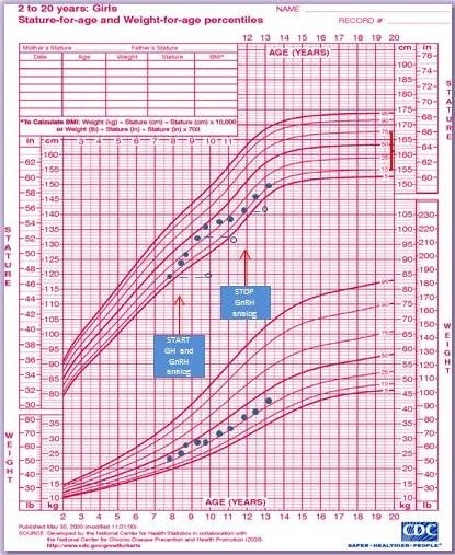 Noonan Growth Chart Weight