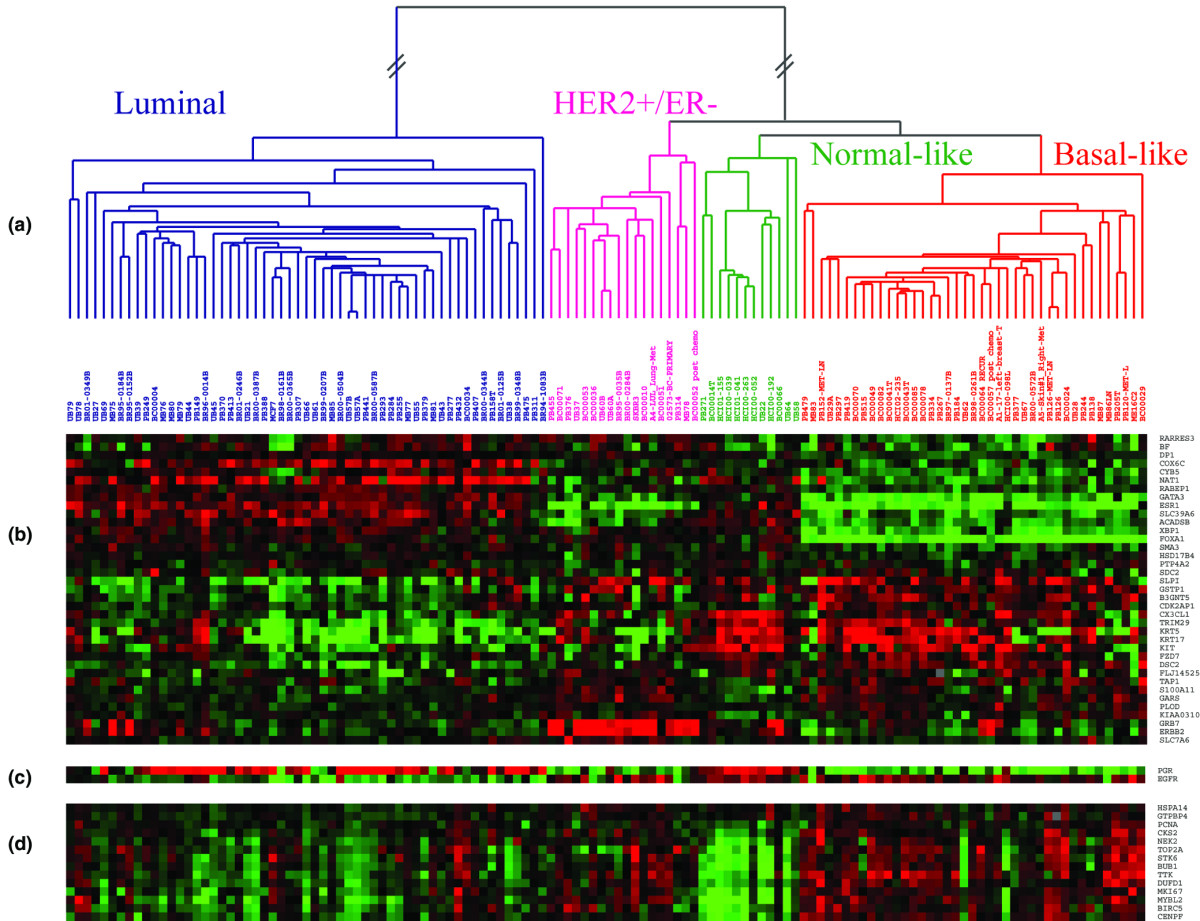 and invasive Classification ... of risk breast stratification breast invasive Classification ... stratification of and risk