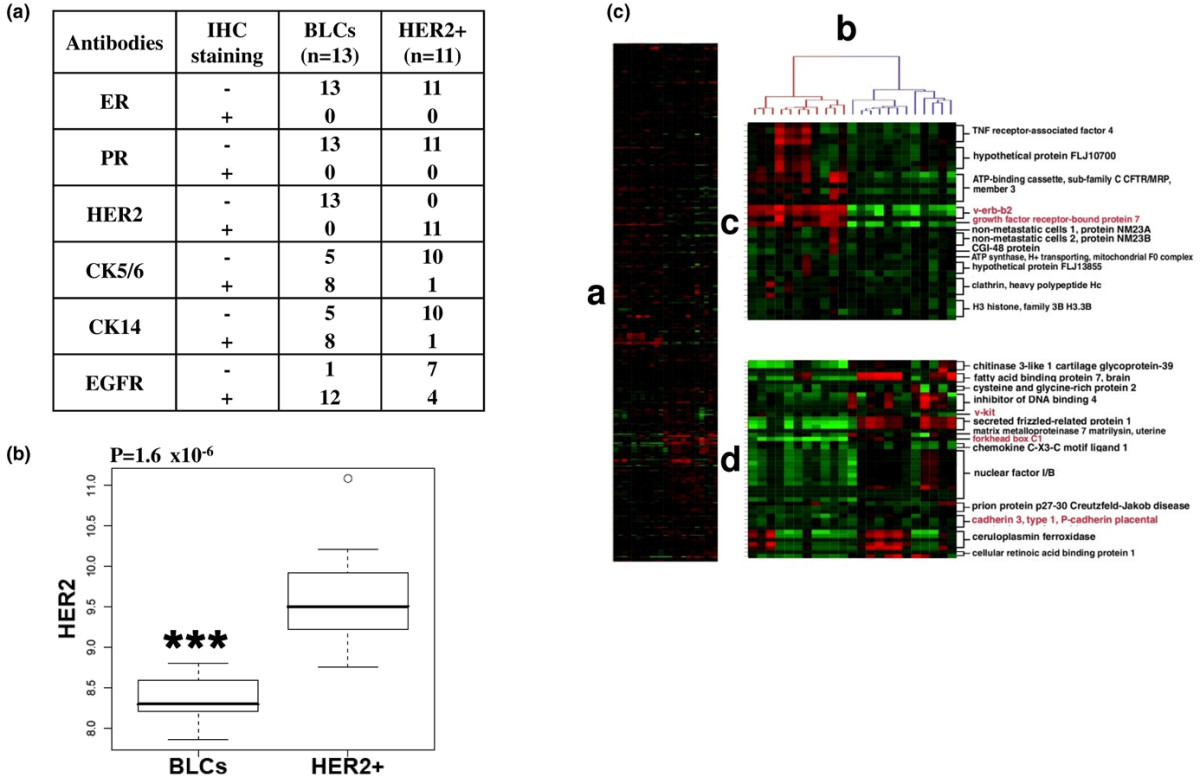 Frequent Pten Genomic Alterations And Activated