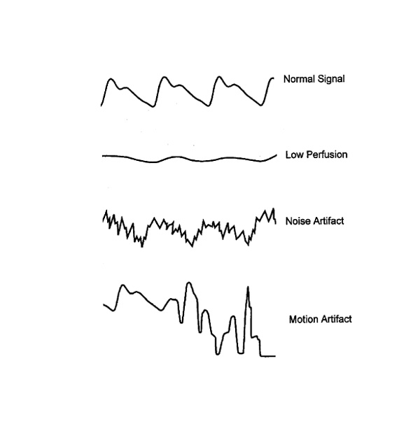 history of pulse oximetry reno Integrated services offers nellcor n-180 pulse oximetry units that are non lease pulse oximeter in oklahoma city ok chickasha, ada, el reno. history of pulse oximetry reno Integrated services offers nellcor n-180 pulse oximetry units that are non lease pulse oximeter in oklahoma city ok chickasha, ada, el reno.